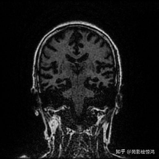 综述｜多重因素共振 全球市场遭遇“黑色星期一”